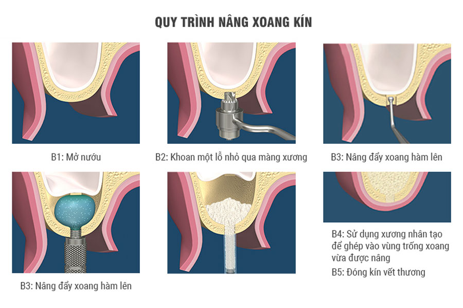 anh-nang-xoang