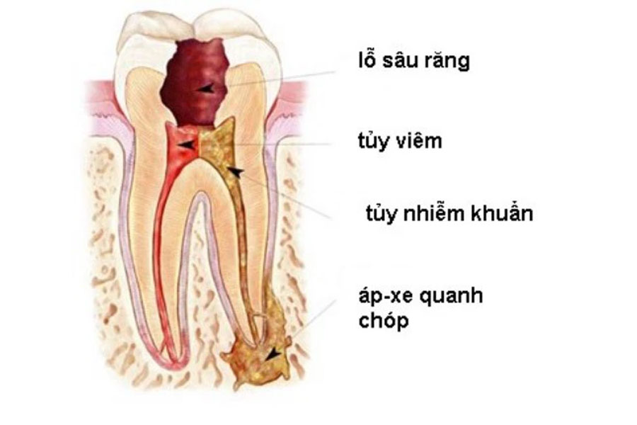 Cuong-rang